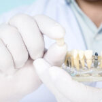 an implant dentist holding a dental implant crown and model.